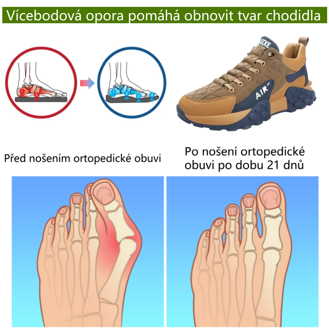 🔥 50% sleva | ortopedická obuv Coesses® | Poskytuje oporu klenby, zmírňuje bolest a usnadňuje chůzi | Vhodná pro muže i ženy.