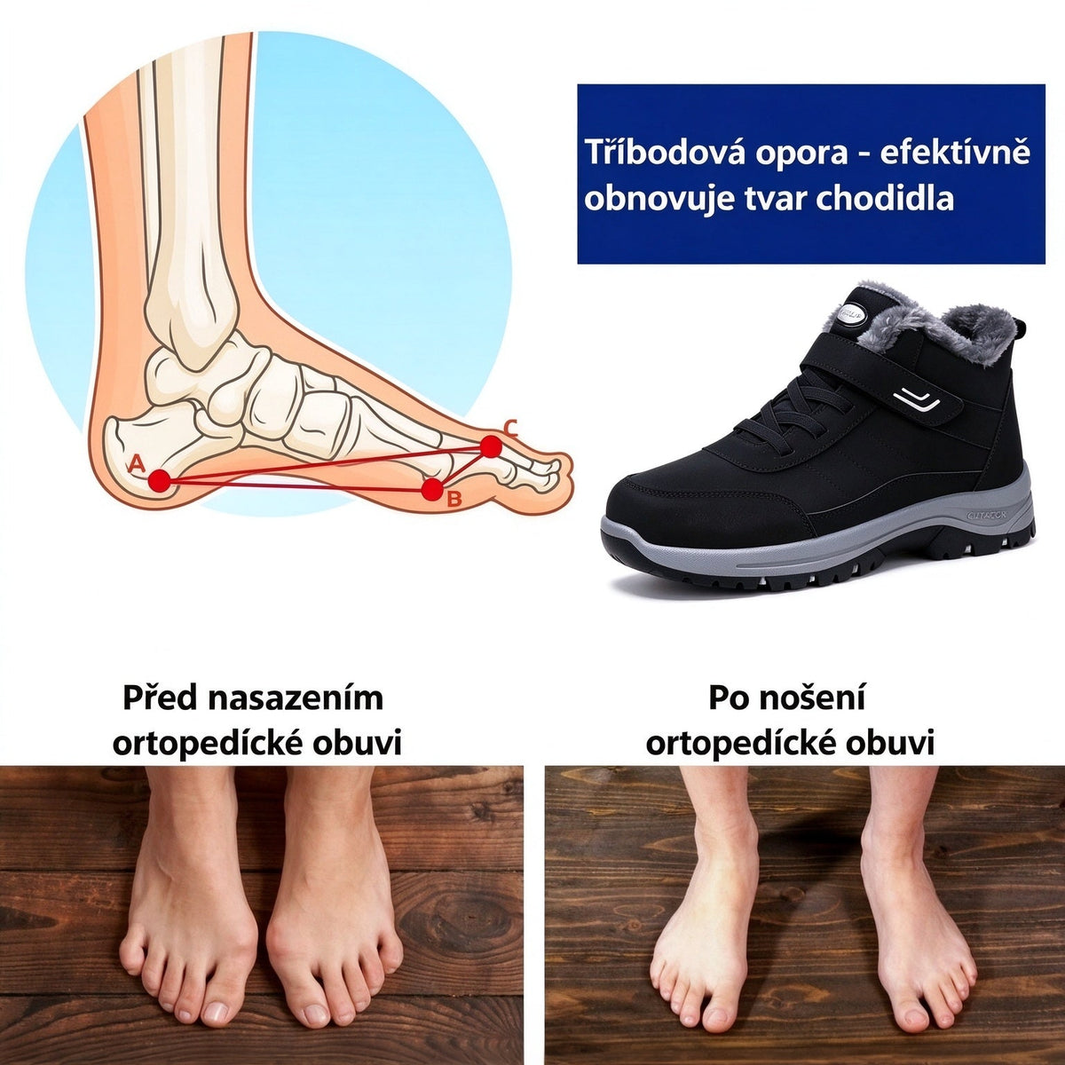 🎉 Poslední den – speciální nabídka se slevou 70 % ⏰ Ergonomická, ortopedická zimní obuv, která účinně ulevuje od bolesti nohou, kolen a zad ✅ Vhodná pro muže i ženy.