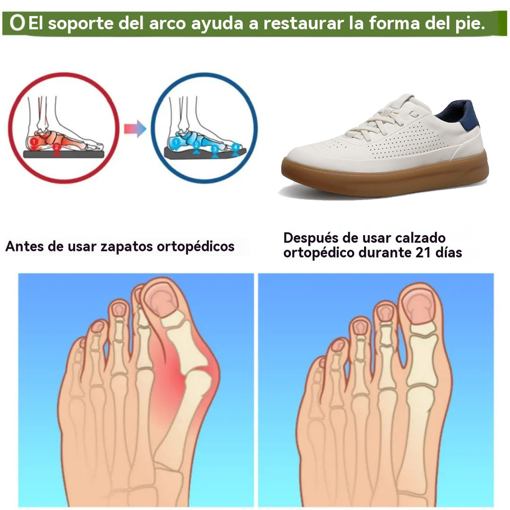 coesses® | Nuevo producto en el mercado, a mitad de precio por tiempo limitado. Diseño ergonómico, excelente amortiguación y corrección de la marcha