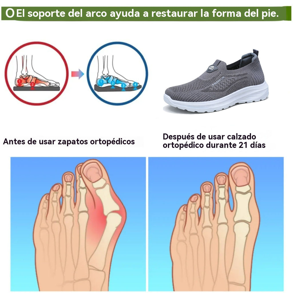 coesses® | Nuevo producto en el mercado, a mitad de precio por tiempo limitado. Diseño ergonómico, excelente amortiguación y corrección de la marcha