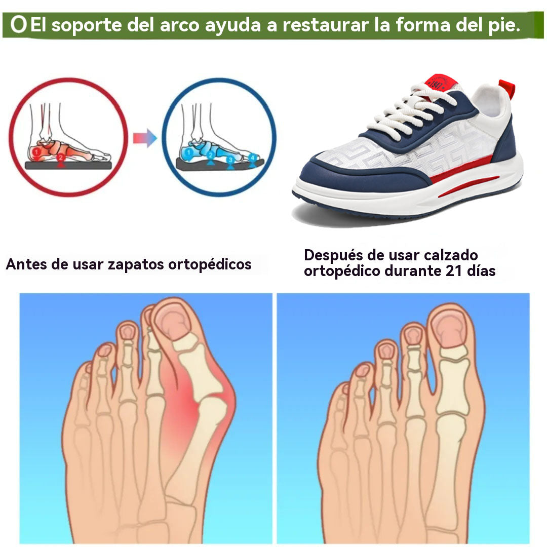 coesses® | Nuevo producto en el mercado, a mitad de precio por tiempo limitado. Diseño ergonómico, excelente amortiguación y corrección de la marcha.