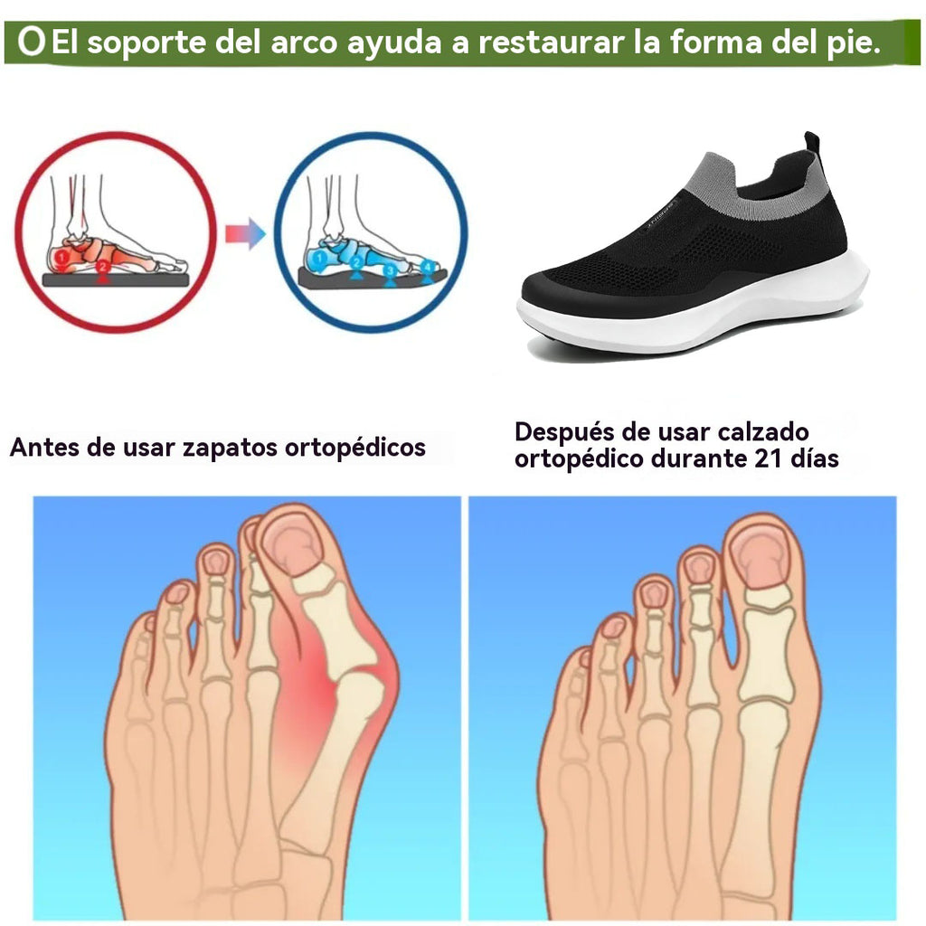 coesses® | Nuevo producto en el mercado, a mitad de precio por tiempo limitado. Diseño ergonómico, excelente amortiguación y corrección de la marcha.