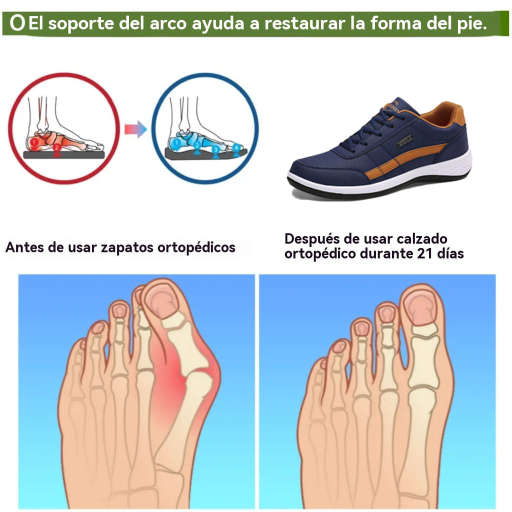 Coesses® | Calzado ortopédico médico profesional - materiales de grado médico - transpirables, suaves para la piel y cómodos, brindando la máxima comodidad para sus pies.