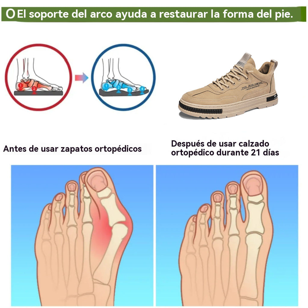 Coesses® | Nuevo producto en el mercado, a mitad de precio por tiempo limitado. Diseño ergonómico, excelente amortiguación y corrección de la marcha.