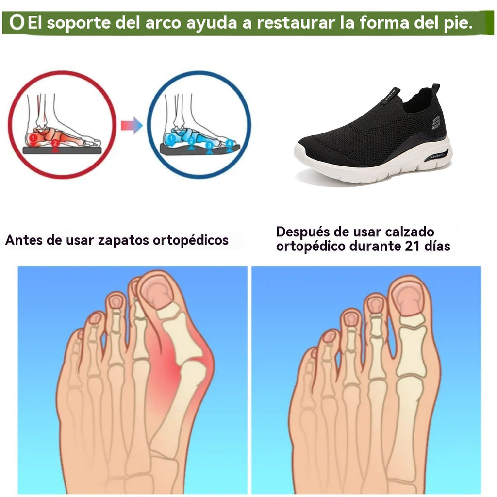 Coesses® | Nuevo producto en el mercado, a mitad de precio por tiempo limitado. Diseño ergonómico, excelente amortiguación y corrección de la marcha.
