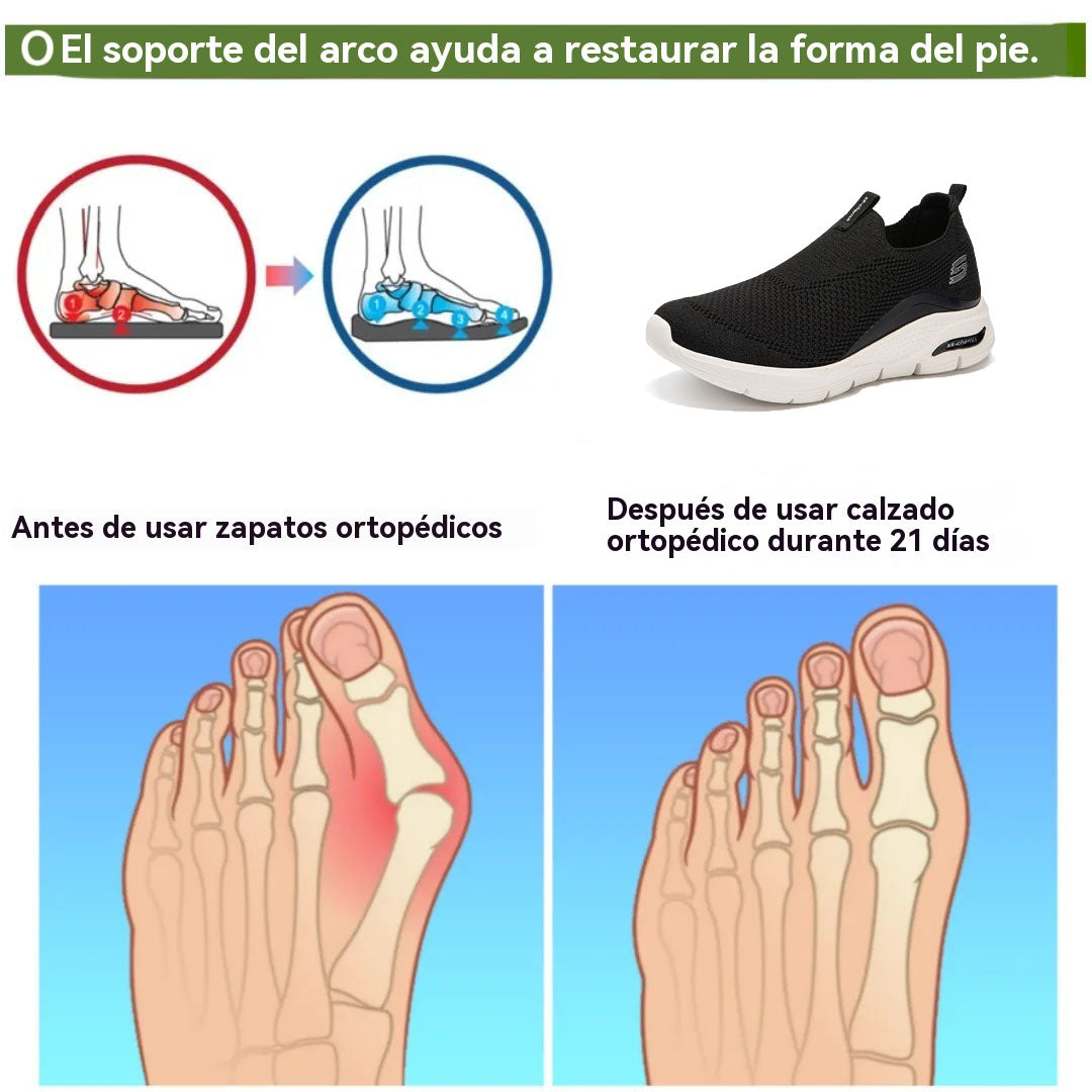 Coesses® | Nuevo producto en el mercado, a mitad de precio por tiempo limitado. Diseño ergonómico, excelente amortiguación y corrección de la marcha.