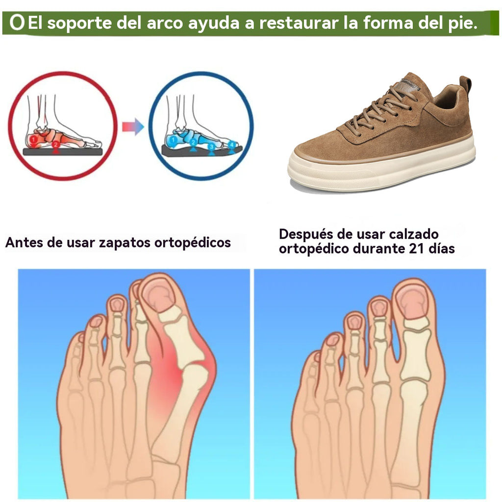 Coesses® | Calzado ortopédico médico con soporte de arco mejorado – Corrección del arco plantar, ideal para largas caminatas.