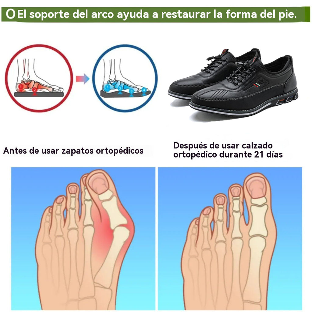 Coesses® | 50% de descuento hoy - ¡no te lo pierdas! Zapatos ortopédicos de cuero suaves y cómodos (con colchón de aire - alivia el dolor de pies - antideslizantes - resistentes al desgaste)