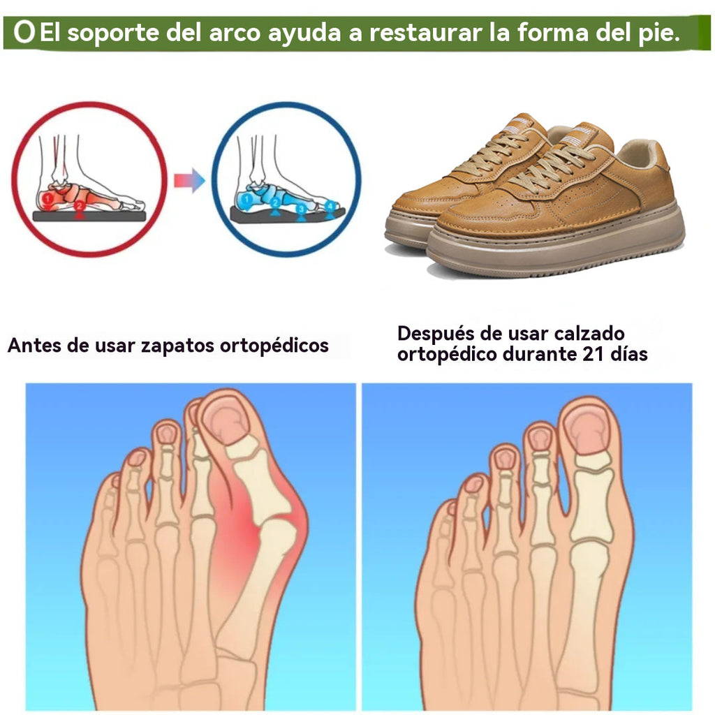 coesses® | Nuevo producto en el mercado, a mitad de precio por tiempo limitado. Diseño ergonómico, excelente amortiguación y corrección de la marcha