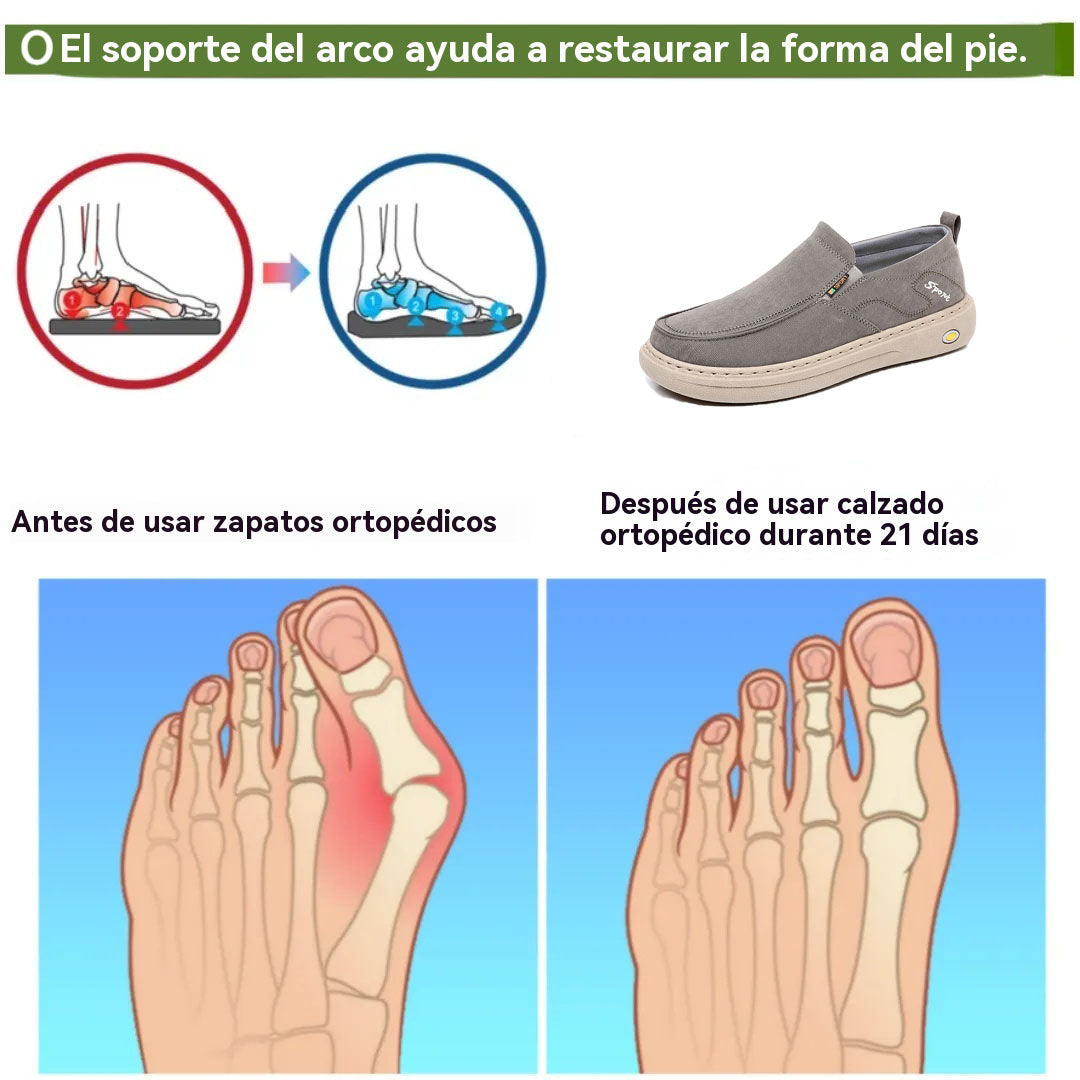 coesses® | Nuevo producto en el mercado, a mitad de precio por tiempo limitado. Diseño ergonómico, excelente amortiguación y corrección de la marcha