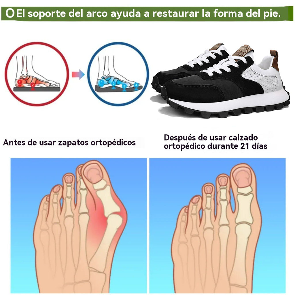 coesses® | Nuevo producto en el mercado, a mitad de precio por tiempo limitado. Diseño ergonómico, excelente amortiguación y corrección de la marcha
