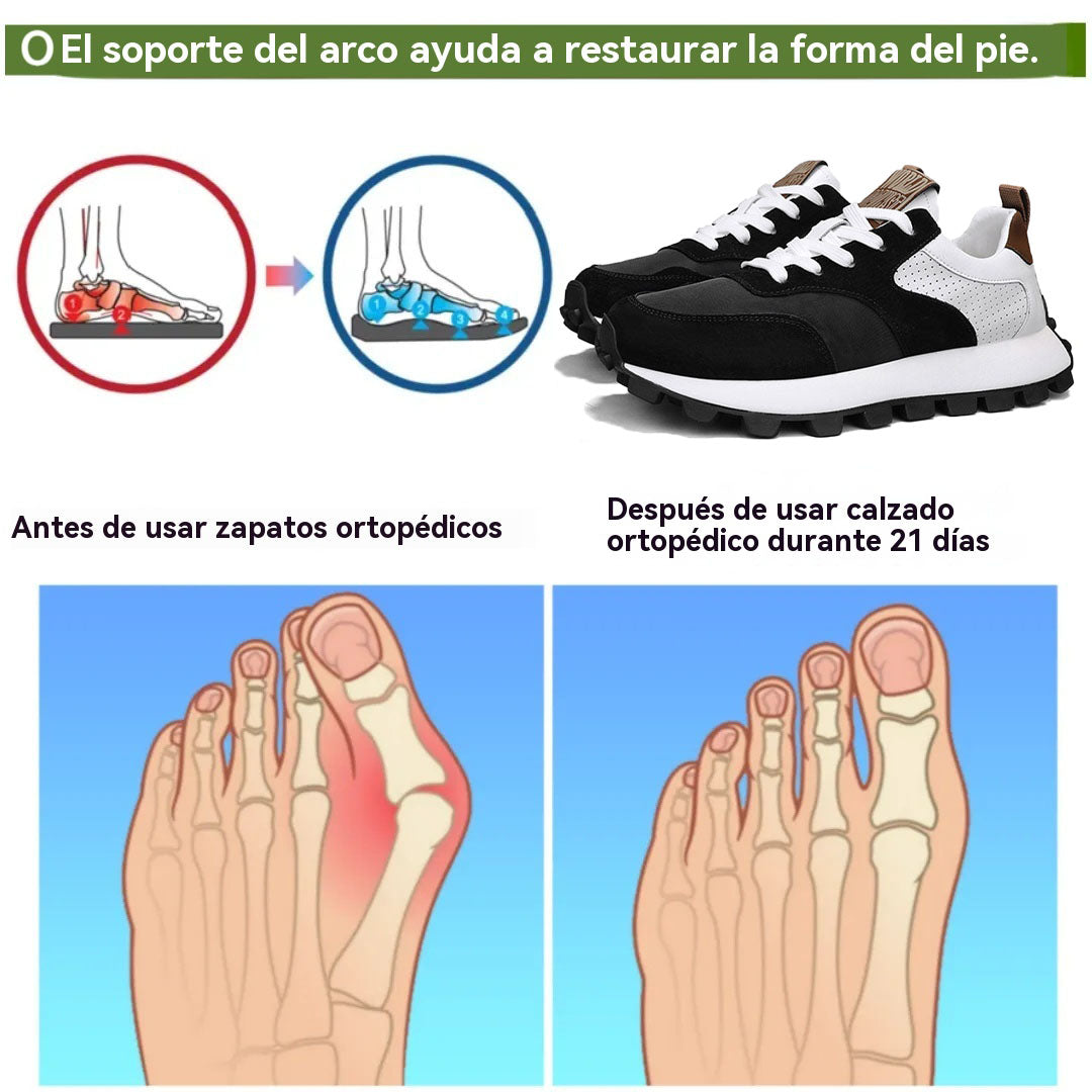 coesses® | Nuevo producto en el mercado, a mitad de precio por tiempo limitado. Diseño ergonómico, excelente amortiguación y corrección de la marcha