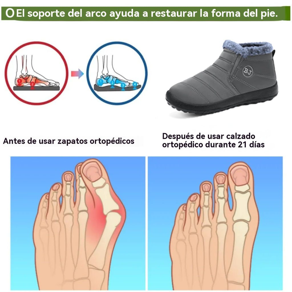 Coesses® | Botas ortopédicas de gamuza italiana de lujo: antideslizantes y cálidas: imprescindibles para condiciones de nieve 👍 Dígale adiós al dolor de pies.