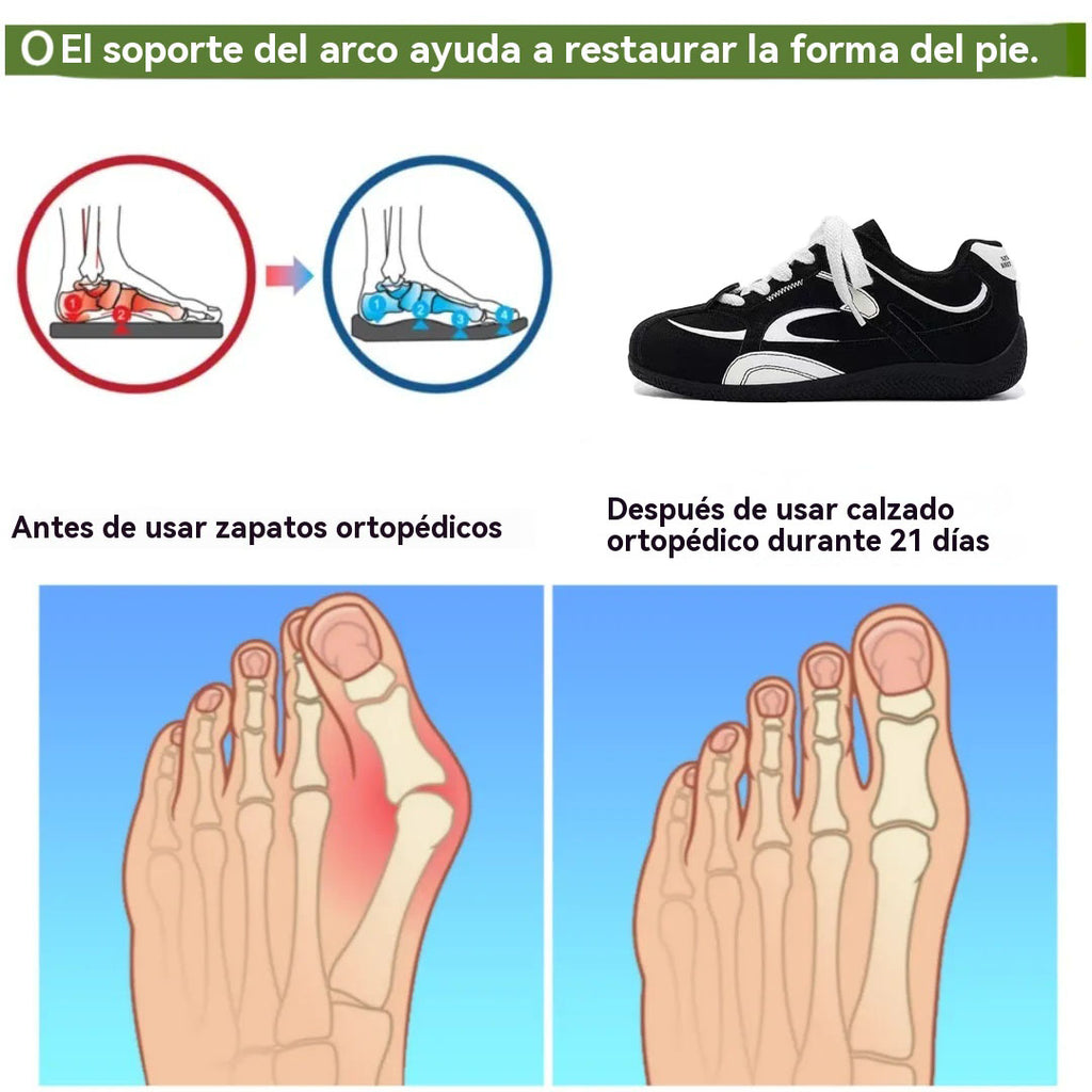 coesses® | Nuevo producto en el mercado, a mitad de precio por tiempo limitado. Diseño ergonómico, excelente amortiguación y corrección de la marcha.