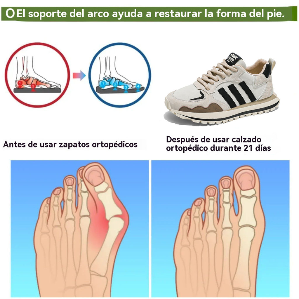 Coesses® | ¡50% de descuento hoy! ¡No te lo pierdas! Zapatos ortopédicos de diseño ergonómico: cuero de alta calidad y cosidos a mano 👞