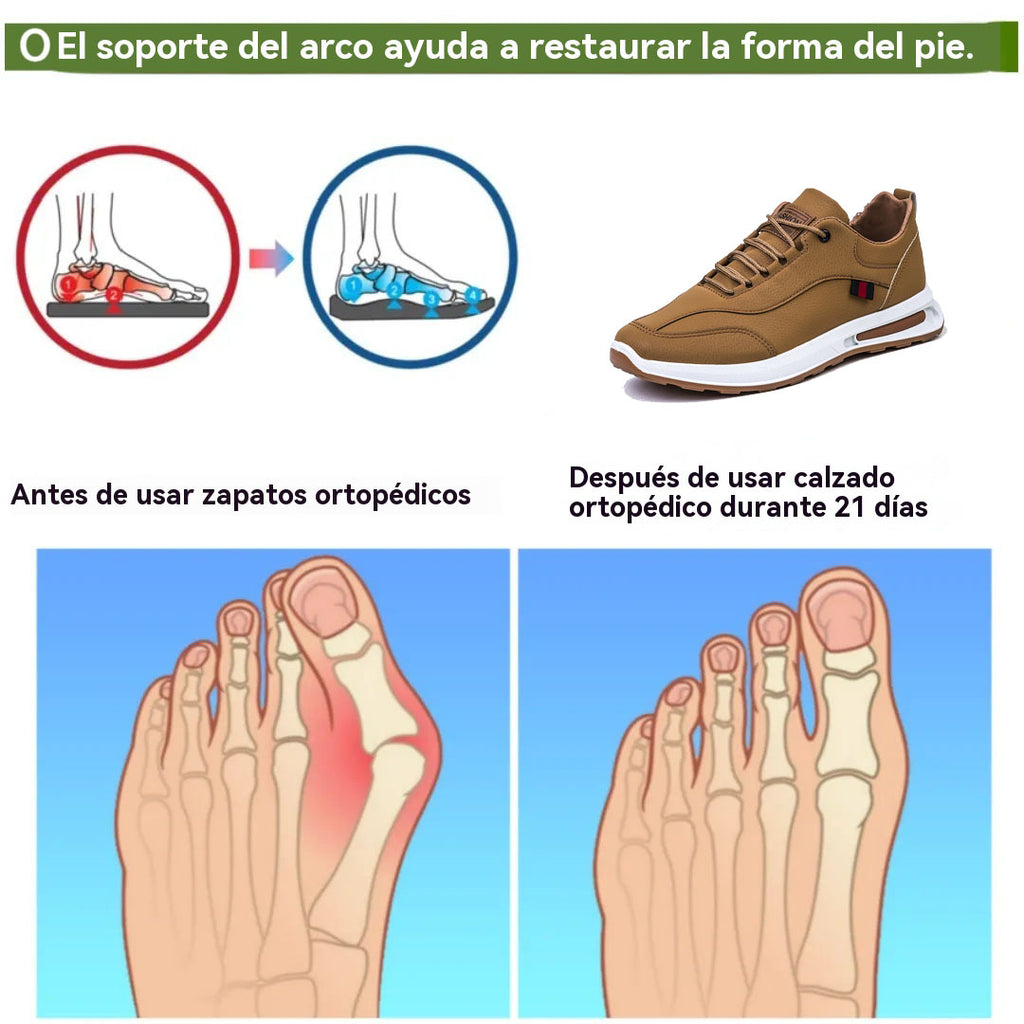 Coesses® | 50% de descuento hoy - ¡no te lo pierdas! Zapatos casuales ortopédicos de cuero para hombre 👞 Soporte arqueado, ligero y cómodo, postura correcta para caminar, alivia el dolor