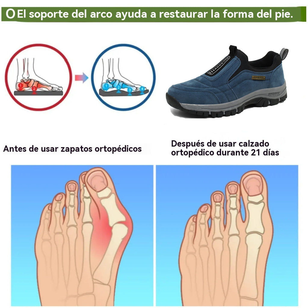 Coesses® – Zapatos ortopédicos médicos diseñados ergonómicamente que alivian el dolor de espalda, articulaciones y piernas.