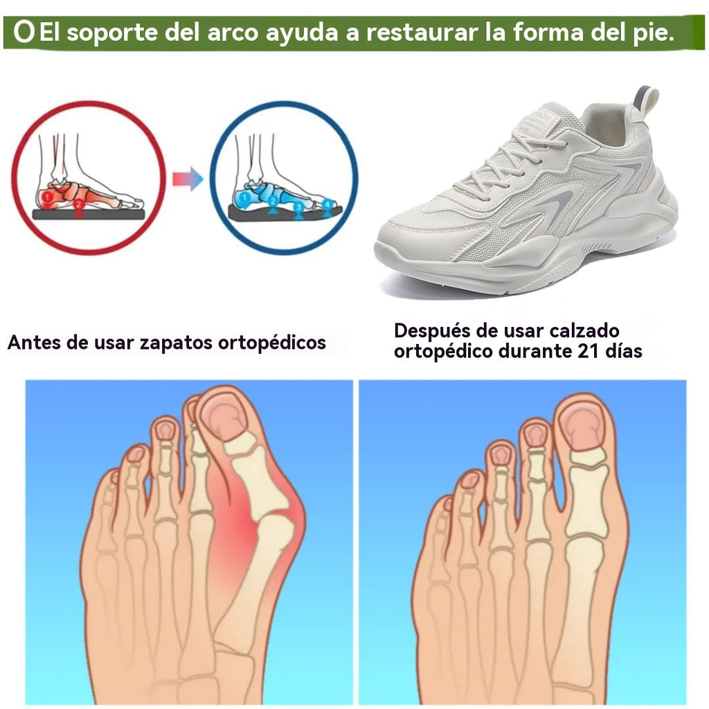 coesses® | Nuevo producto en el mercado, a mitad de precio por tiempo limitado. Diseño ergonómico, excelente amortiguación y corrección de la marcha.