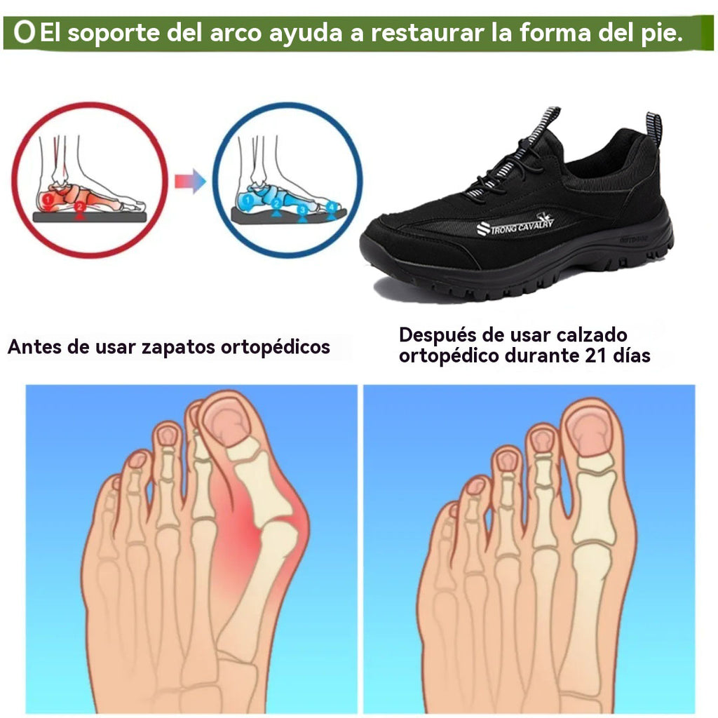 Coesses® | ¡70% de descuento hoy! ¡No te lo pierdas! Zapatos ortopédicos de diseño ergonómico - Piel de primera calidad + Cosidos a mano 👞