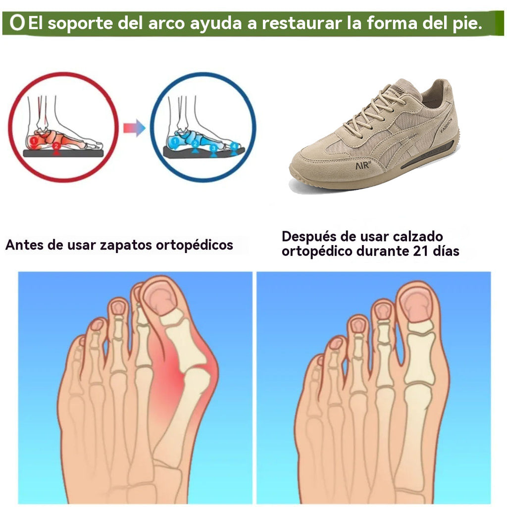 Coesses® | Nuevo producto en el mercado, a mitad de precio por tiempo limitado. Diseño ergonómico, excelente amortiguación y corrección de la marcha