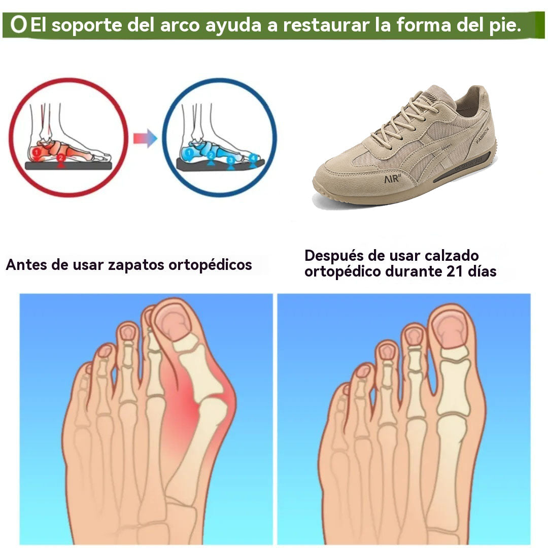 Coesses® | Nuevo producto en el mercado, a mitad de precio por tiempo limitado. Diseño ergonómico, excelente amortiguación y corrección de la marcha