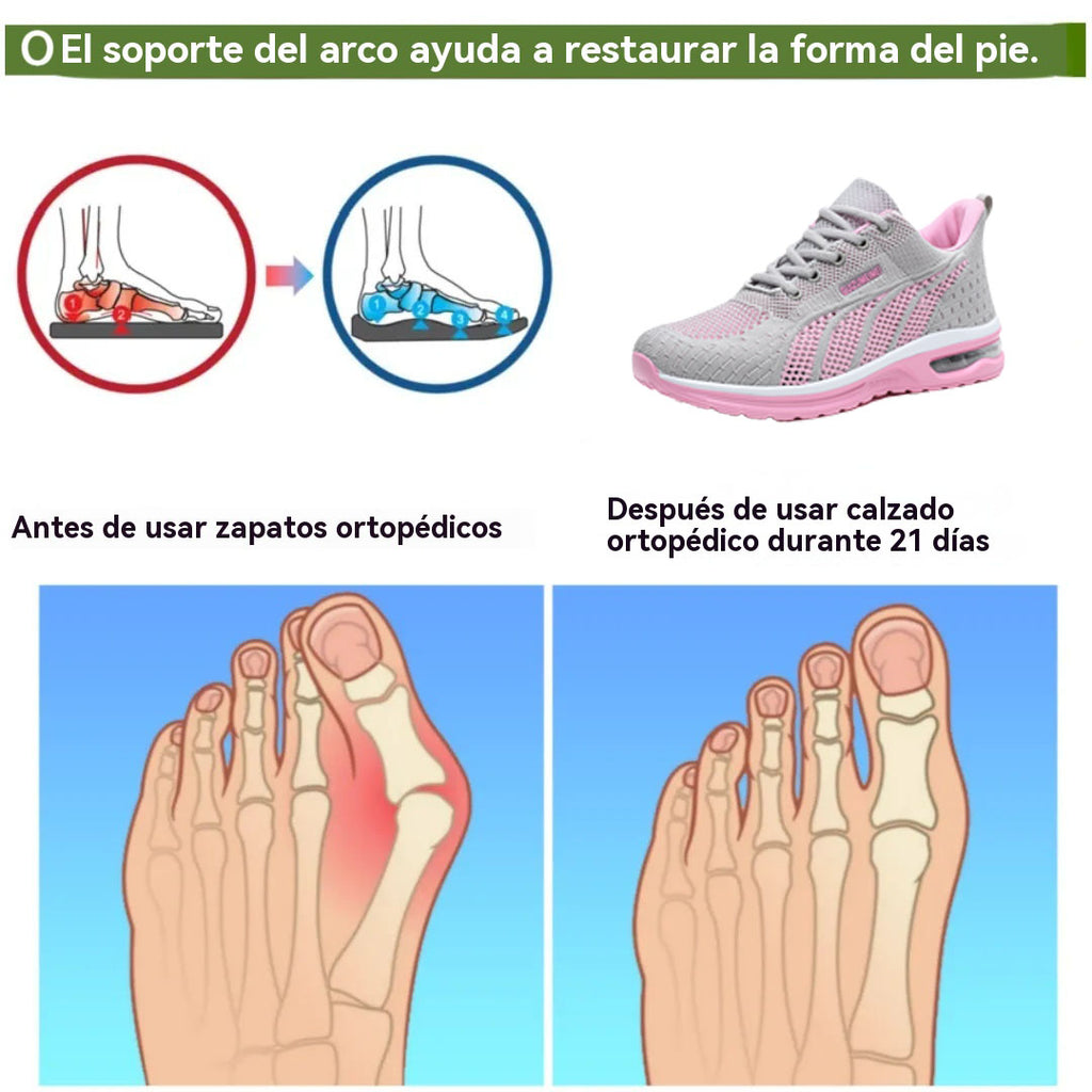 Coesses® | Zapatos ortopédicos - Diseño ergonómico - Alivia el dolor de espalda, pies y articulaciones
