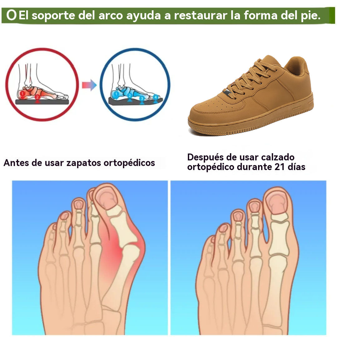coesses® | Nuevo producto en el mercado, a mitad de precio por tiempo limitado. Diseño ergonómico, excelente amortiguación y corrección de la marcha