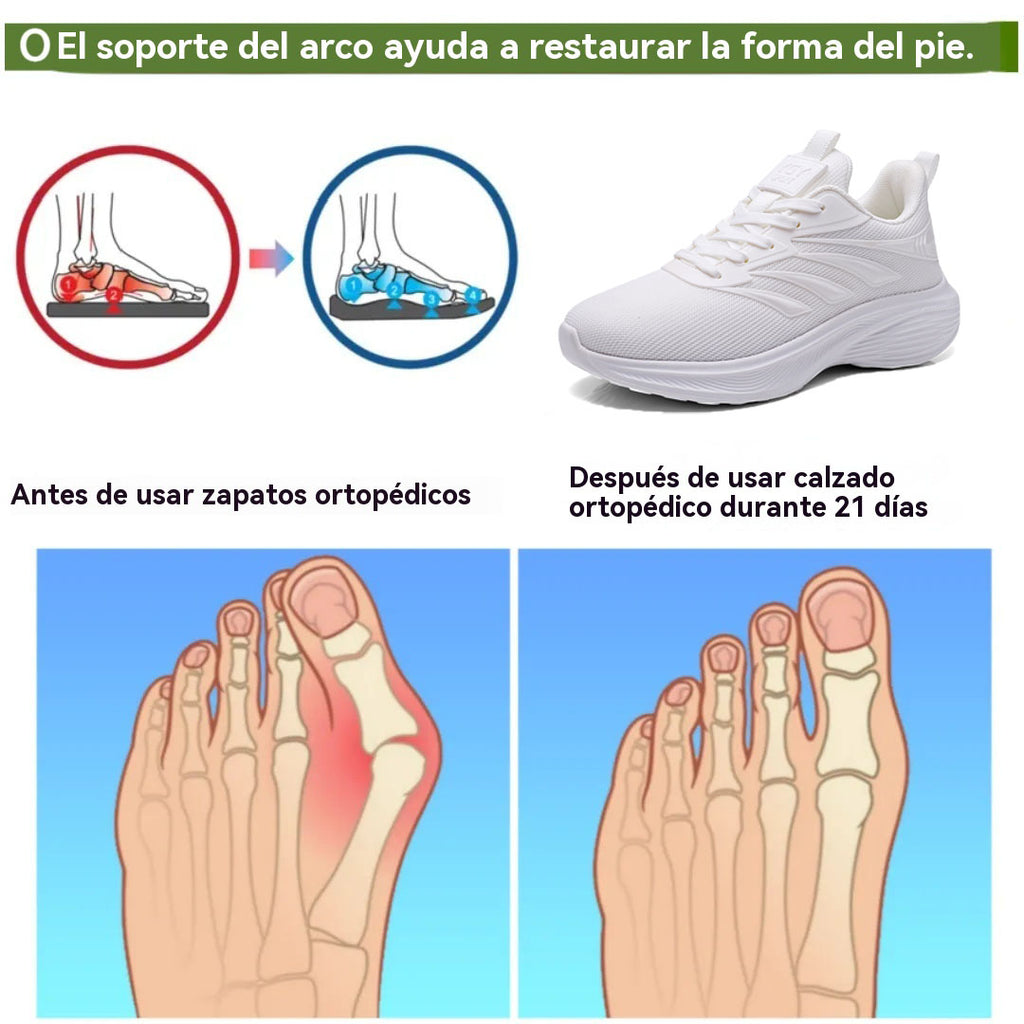 Coesses® | Nuevo producto en el mercado, a mitad de precio por tiempo limitado. Diseño ergonómico, excelente amortiguación y corrección de la marcha.