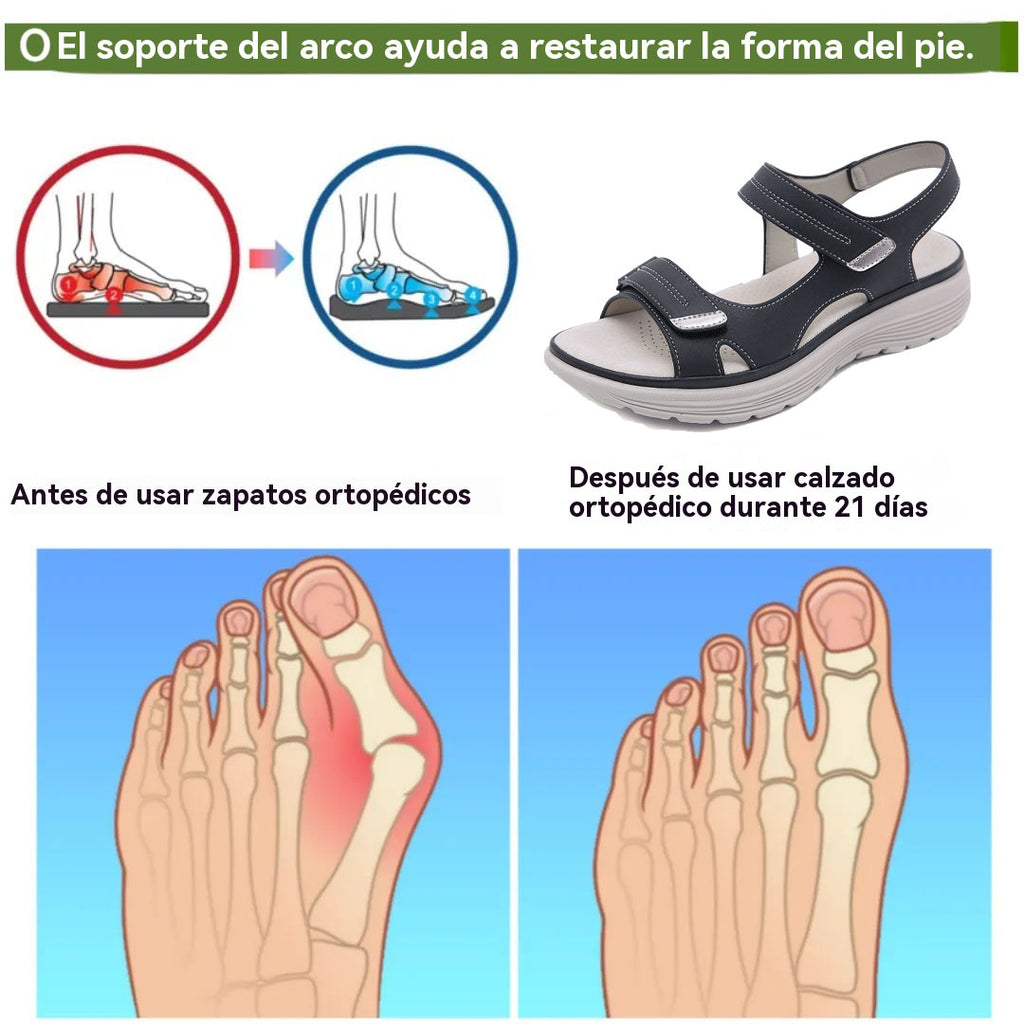 coesses® | Nuevo producto en el mercado, a mitad de precio por tiempo limitado. Diseño ergonómico, excelente amortiguación y corrección de la marcha