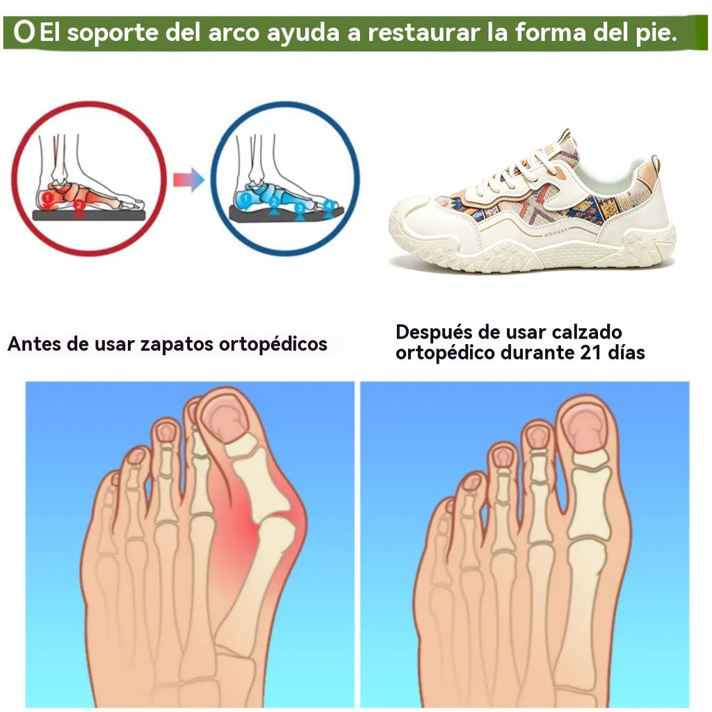coesses® | Nuevo producto en el mercado, a mitad de precio por tiempo limitado. Diseño ergonómico, excelente amortiguación y corrección de la marcha