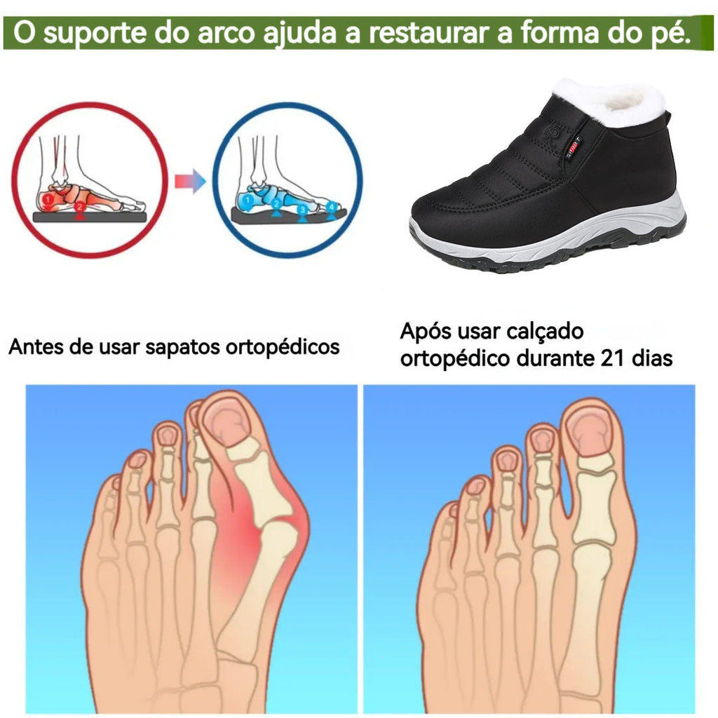 Coesses® | Zapatos ortopédicos ergonómicos: alivia el dolor y abriga en invierno