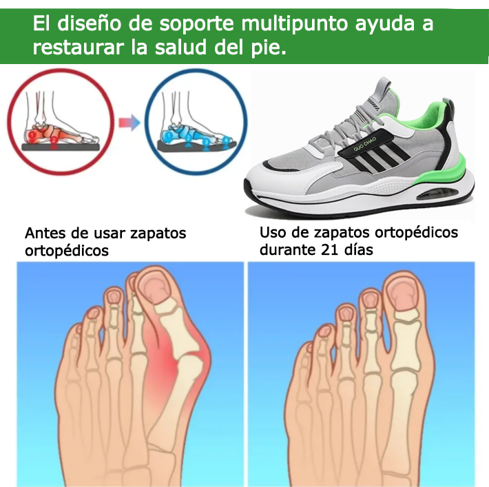 Coesses® 【🔥¡Hoy a mitad de precio! ⏰】Comodidad para caminar todo el día | Diseño con soporte para el arco | Súper amortiguación | Alivia el dolor de pies | Impermeable y antideslizante | Corrige la marcha👟