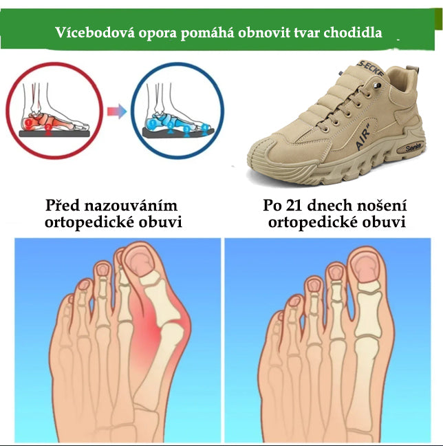 Ortopedická obuv coesses® | Ergonomická turistická obuv - ✅️Korekce držení těla při chůzi - Voděodolná a protiskluzová 👞Vybraná italská kůže