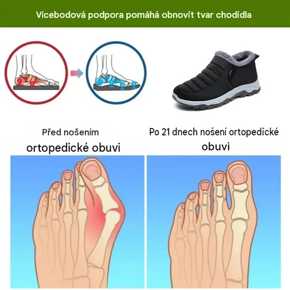 🎉Dnešní speciální nabídka: Sleva 70 % – Nenechte si to ujít! ⏰Ergonomická zimní ortopedická obuv pro úlevu od bolesti chodidel, kolen a zad – unisex